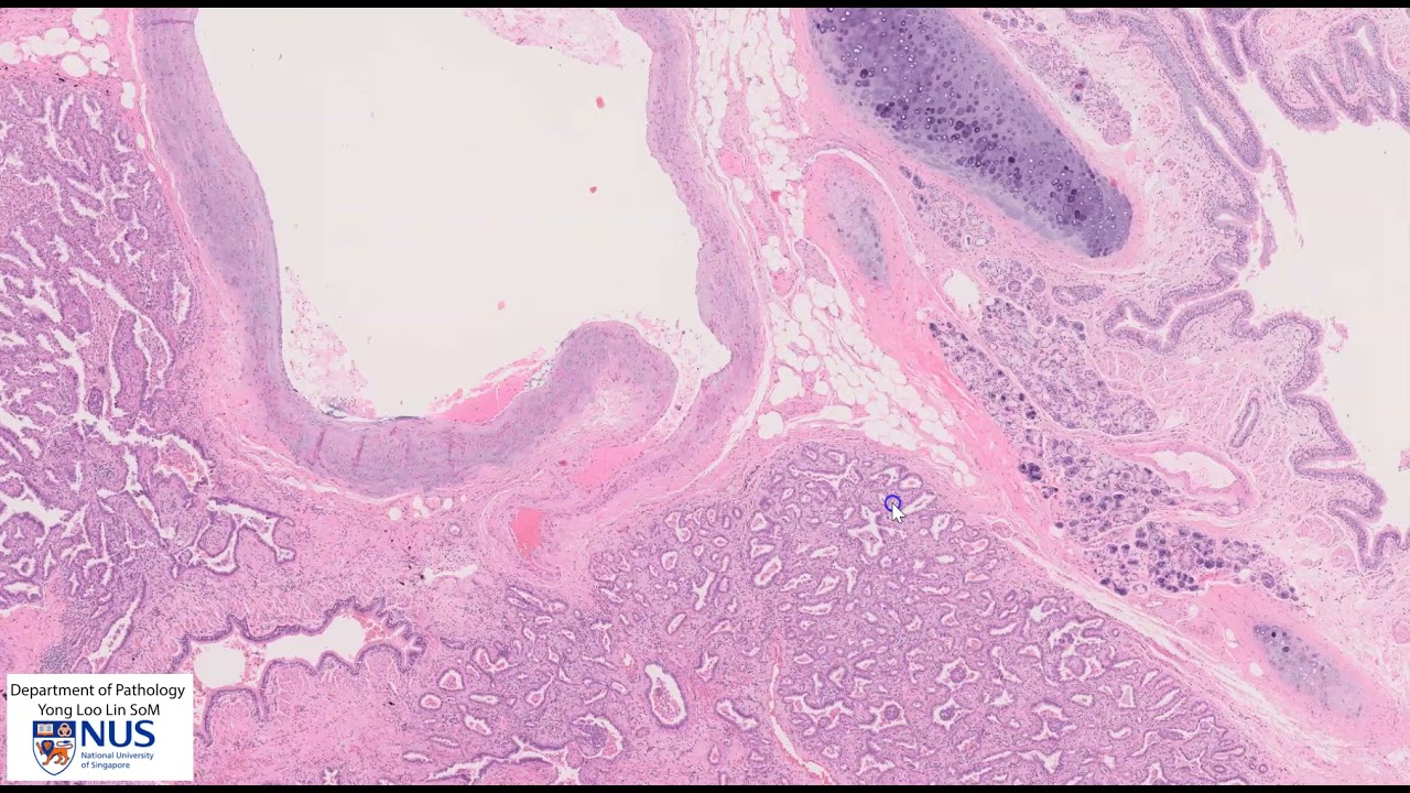 Pathology AI Initiative mobile product interface